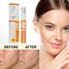 VC Whitening Instant Blemish Pen Remove Melasma Pigment Melanin Dark Spot Gel Freckle Cream Face Brighten Skin Repair Anti Aging