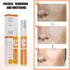 VC Whitening Instant Blemish Pen Remove Melasma Pigment Melanin Dark Spot Gel Freckle Cream Face Brighten Skin Repair Anti Aging